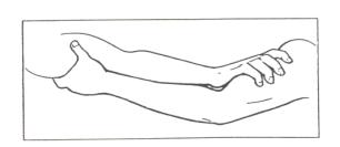 Cuadro de texto: Presa brazo - brazoSe usa principalmente para sujetar una posición invertida. El portor sujeta por el tríceps y el ágil por la unión deltoides-brazo.
